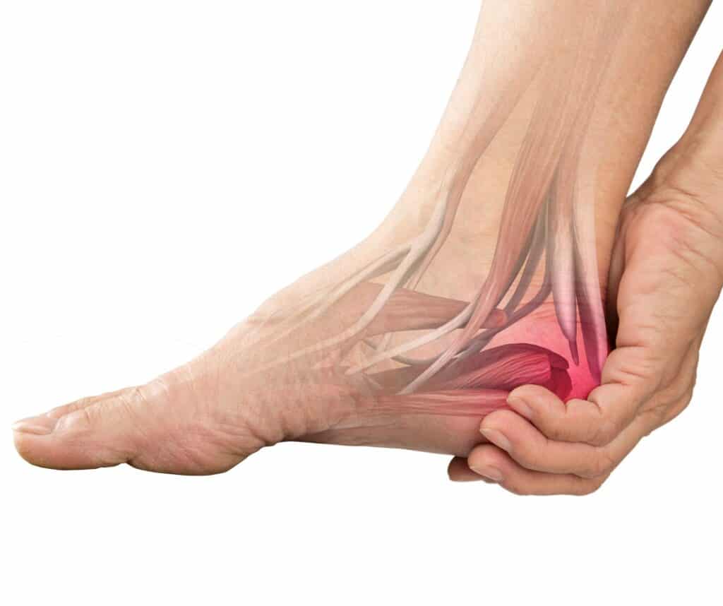 Common causes of heel pain - Sydney Foot Solutions | Podiatrists that treat foot  pain, heel pain, plantar fasciitis and bunions